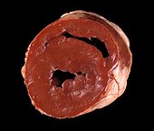 Section of a heart of sheep
