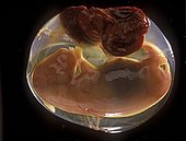 Embryo of mouse 