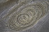 Trichina worm encysted in a human muscle under microscope ; Light phase contrast and enlargement X 250.<br>@ Cyst