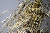 Cut of human muscle infested by Trichinella spiralis