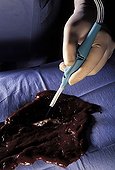 Surgeon and its water dissecting water-jet