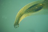 Digestive system of Ancyclosoma parasite in microscopy ; Lighting in polarized light, magnification x 100