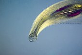 Digestive system of Ancyclosoma parasite in microscopy ; Lighting in polarized light, magnification x 100