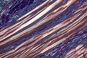 Transversal cut of a tongue striated muscle ; Lighting in polarized light, magnification x 200