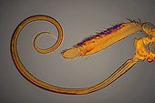 Mouthpieces of a butterfly under microscope  ; Lighting in clear bottom, magnification x 20.