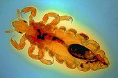 Human lice under microscope  ; Lighting in clear bottom, magnification x 50.