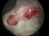 Embryo in an egg frozen Emperor Penguin Adelie Land 