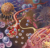 Nerve ending, seen in lower right, sends pain message from injured muscle. Blood vessel and immune cells are seen in the center and upper right of image.