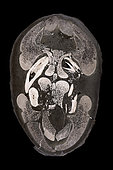 Ichthyosaur. Themnodontosaurus sp. Toarcian (180 million years). Germany. Cross-section of a rostrum, showing the different stages of tooth growth (large tooth with root, small sprouting tooth without root), diagnostic of the mechanism of continuous tooth growth in ichthyhyosaurs. - Blouet brothers collection